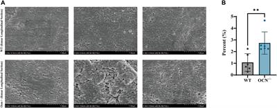 Triple-gene deletion for osteocalcin significantly impairs the alignment of hydroxyapatite crystals and collagen in mice